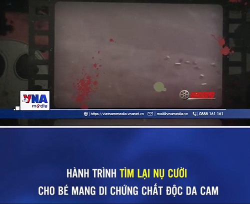 HÀNH TRÌNH TÌM LẠI NỤ CƯỜI CHO BÉ MANG DI CHỨNG CHẤT ĐỘC DA CAM